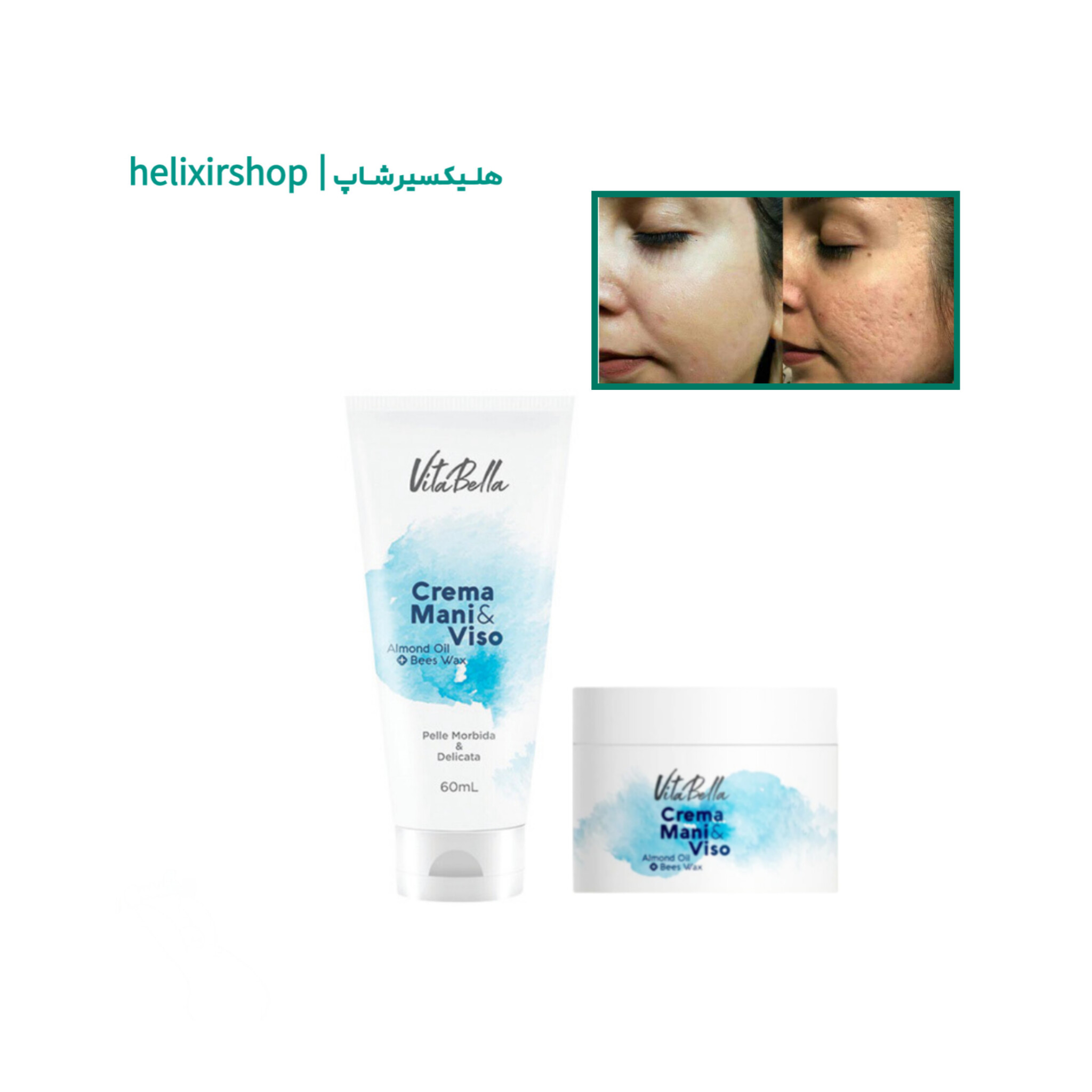 کرم موم زنبور و روغن بادام ویتابلا ۶۰ml | آبرسان ، رفع چروک ، رفع کدری